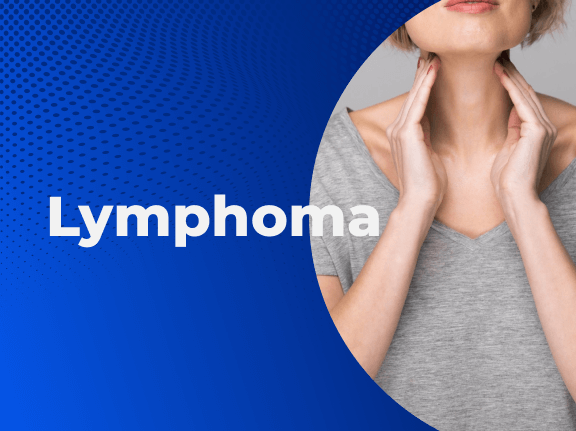 Lymphoma Basics