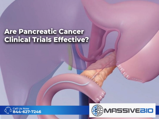Are Pancreatic Cancer Clinical Trials Effective?