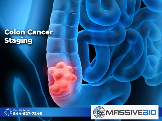 Colon Cancer Staging