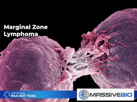 Marginal Zone Lymphoma