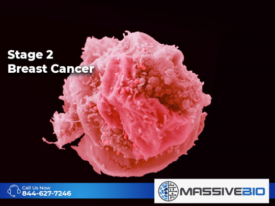 breast cancer stage 2 life expectancy