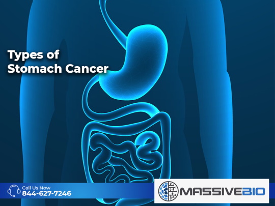 Types of Stomach Cancer
