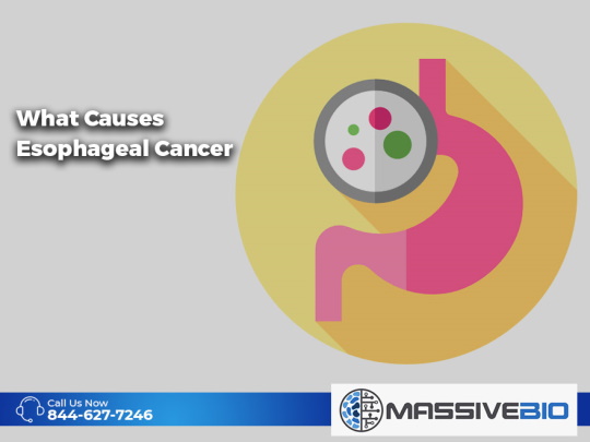 What Causes Esophageal Cancer?