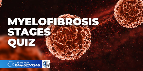 Myelofibrosis Stages Quiz