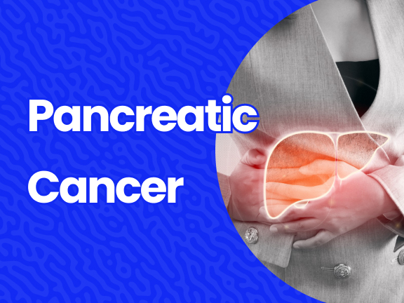 Pancreatic cancer