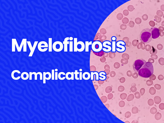 Complications of Myelofibrosis
