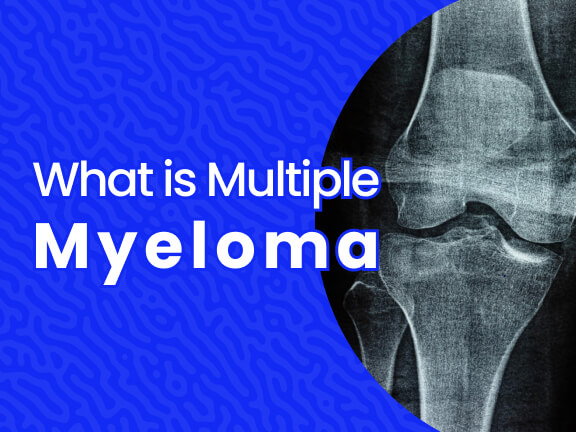 What Is Multiple Myeloma?