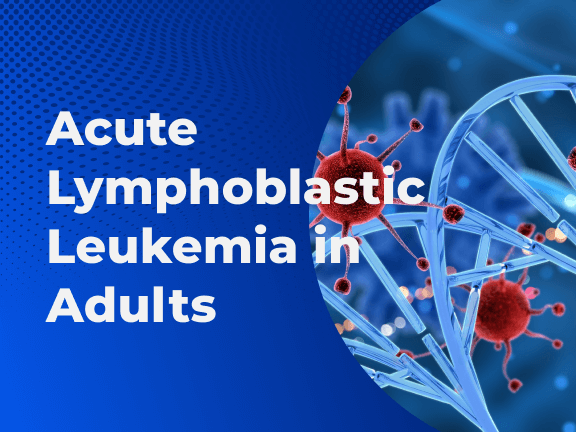 Acute Lymphoblastic Leukemia in Adults2