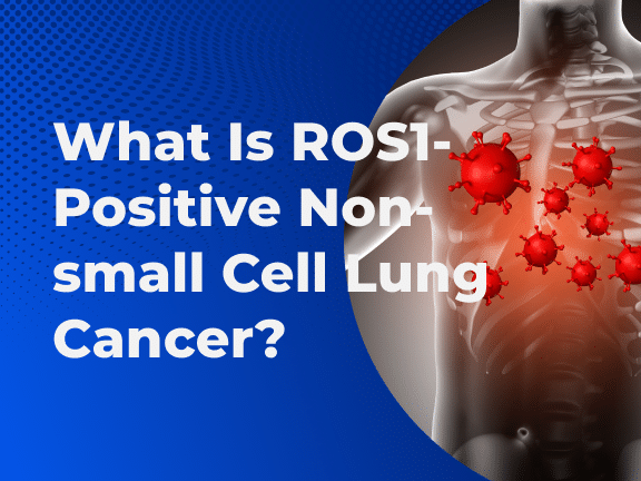 What Is ROS1-Positive Non-small Cell Lung Cancer