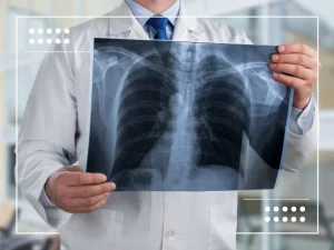 Entschlüsselung neuer Horizonte: Erforschung klinischer Studien für metastasiertes NSCLC