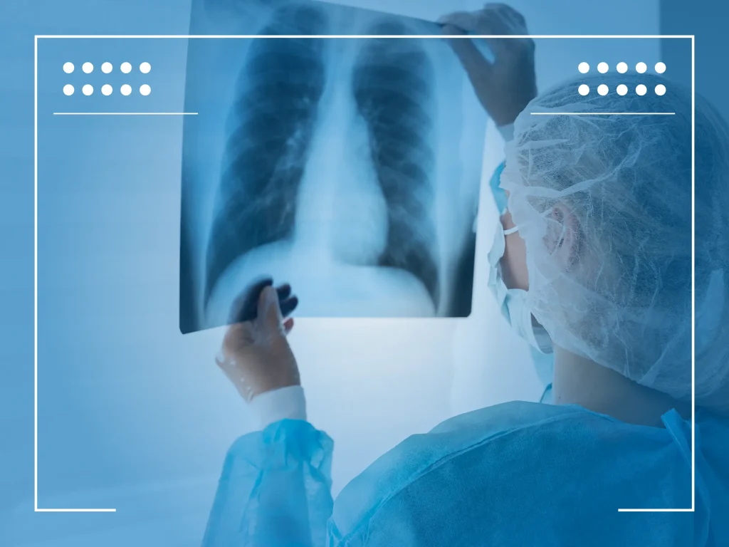 Lung Cancer Treatment