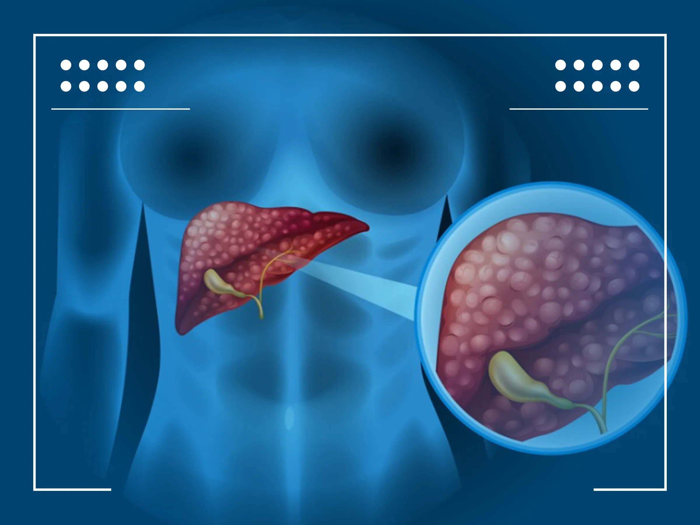 liver tumor