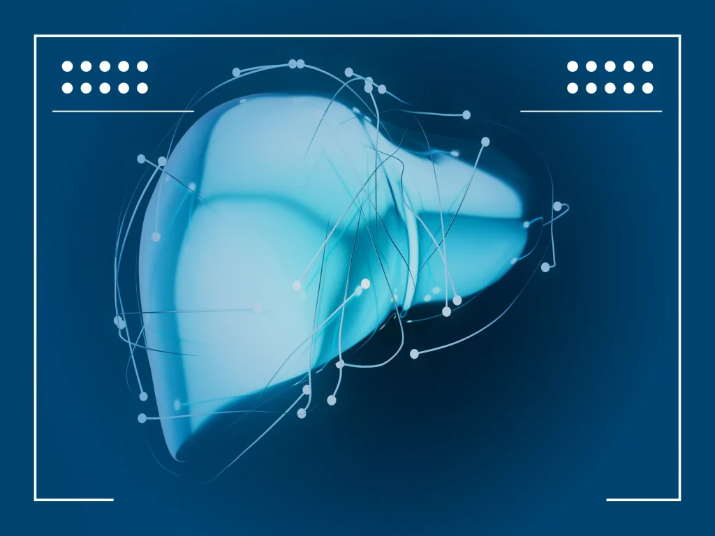 Hepatocellular Carcinoma