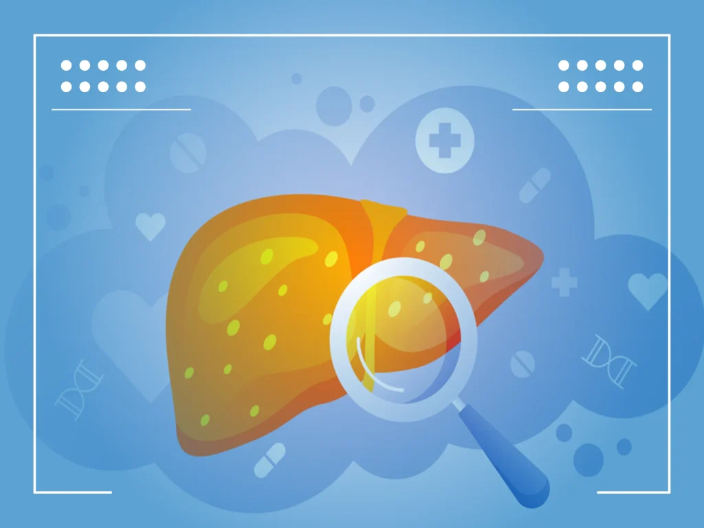 Leberkarzinom Leberkarzinom Symptome