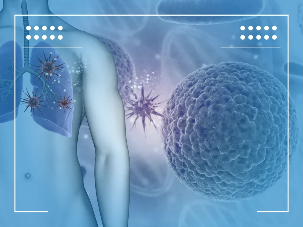 Lung cancer metastasis