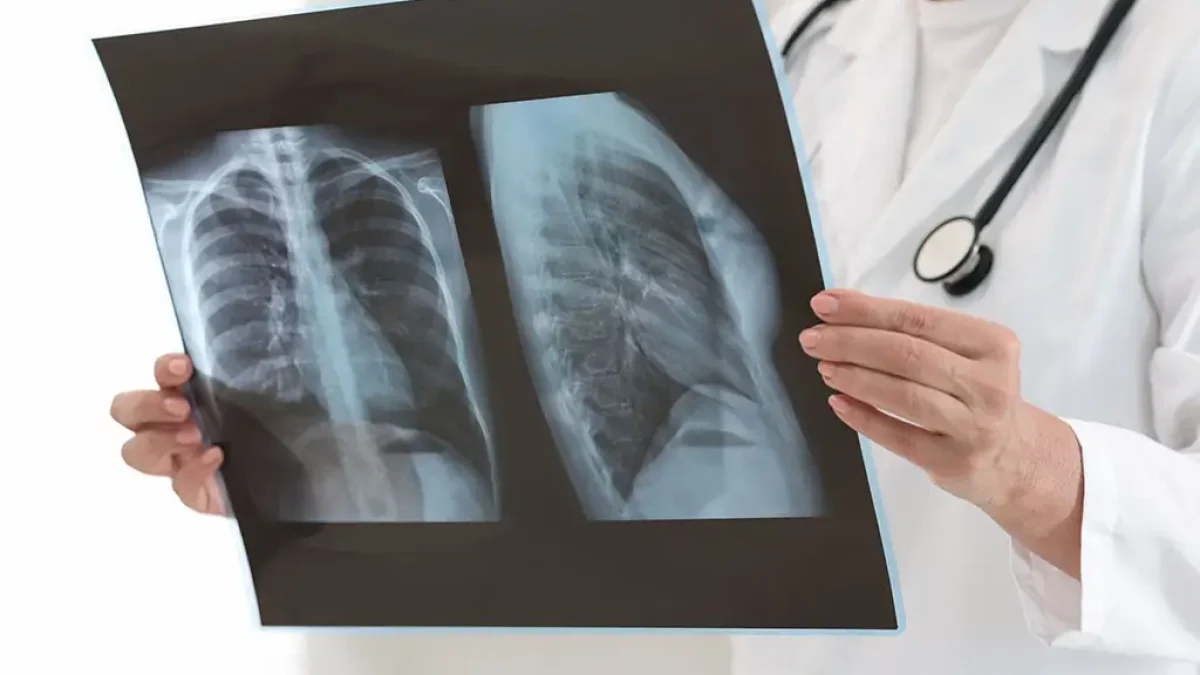 Stage 1 Lung Cancer Symptoms: When Should You See a Doctor