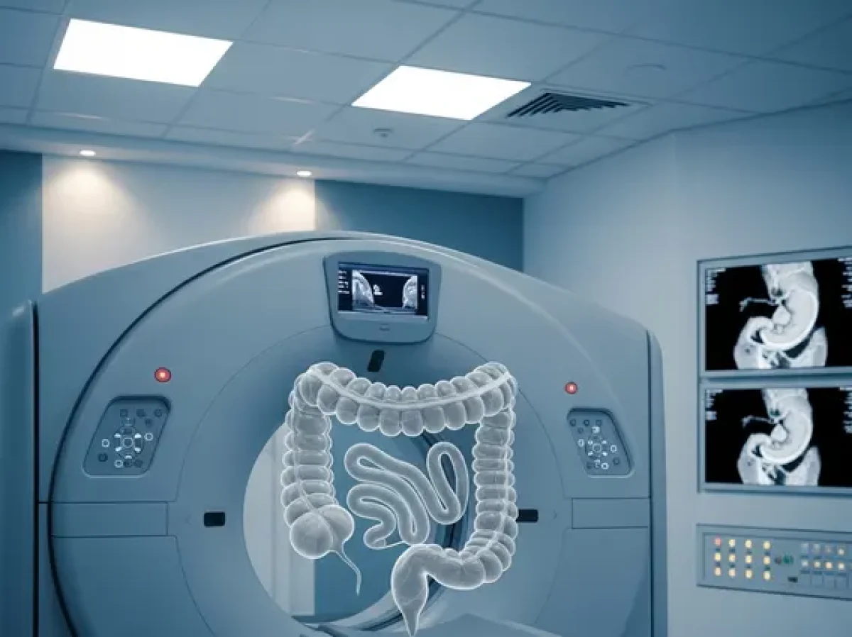 Computed Tomographic Colonography