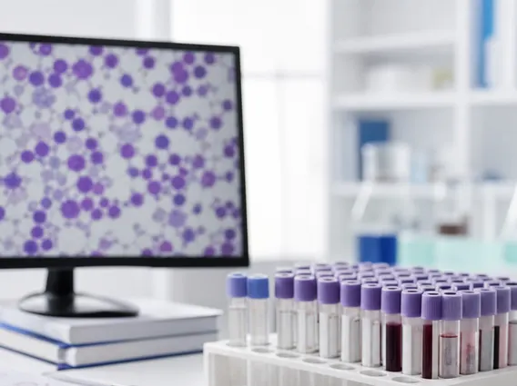 Chronic Lymphocytic Leukemia Small Lymphocytic Lymphoma
