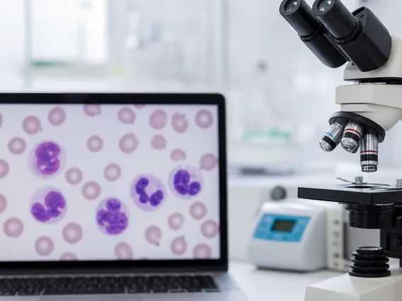 Chronic Neutrophilic Leukemia