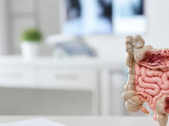 Radiation Enteritis