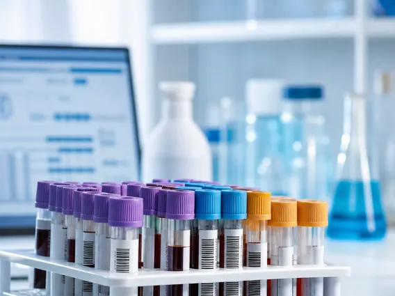 Laboratory Test