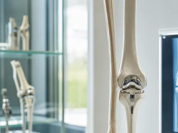 Limb Sparing Surgery